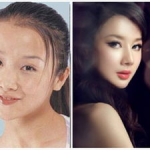 女明星整容前照片,对比前后惊人变化
